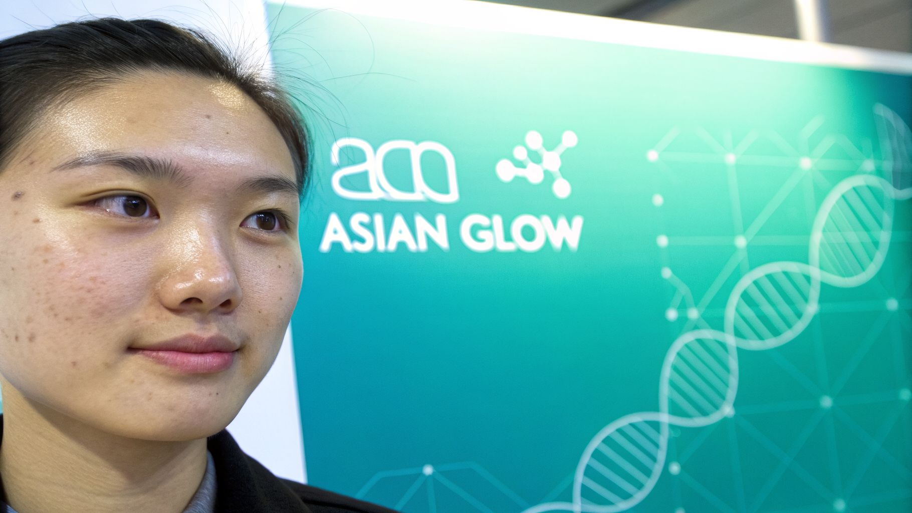 What Causes Asian Glow And How to Manage It - Upside Hangover Jelly